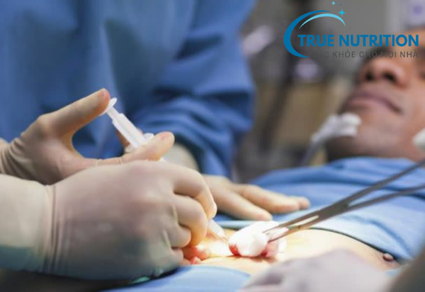 viêm loét dạ dày có phải mổ không