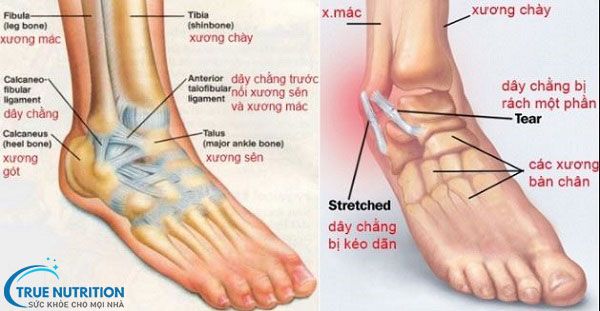 3 Cách Chữa Lật Sơ Mi Cổ Chân Nhanh Nhất