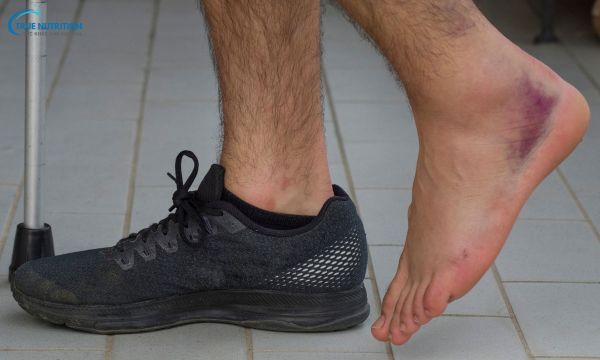 3 Cách Chữa Lật Sơ Mi Cổ Chân Nhanh Nhất