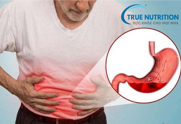 xuất huyết dạ dày có phải mổ không