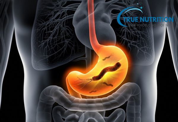 chữa hp dạ dày bằng lá vối và đinh lăng