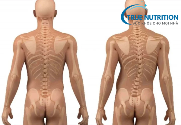 Số Lượng Xương Khớp Trong Cơ Thể: Thông Tin Cần Biết