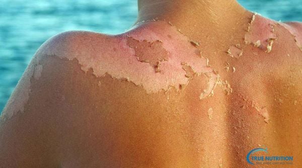 Cách Nhả Nắng Nhanh, Khi Nào Da Mới Nhả Nắng?