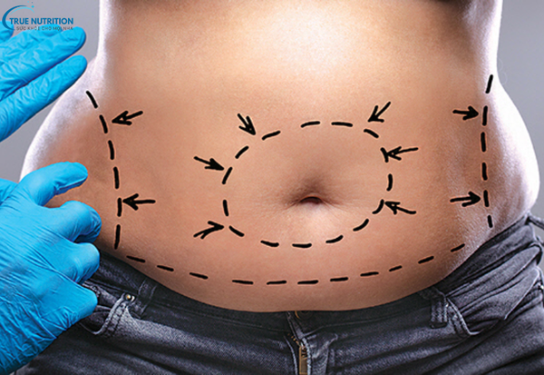 Nguyên Nhân Bệnh Béo Phì: Những Yếu Tố Dẫn Đến Tình Trạng Thừa Cân