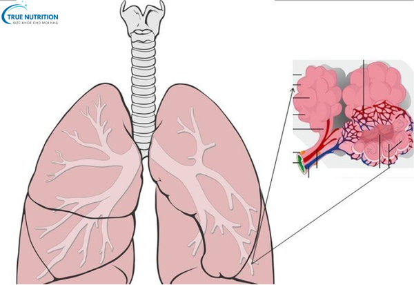 Triệu chứng bệnh bụi phổi: Những dấu hiệu cảnh báo không thể bỏ qua