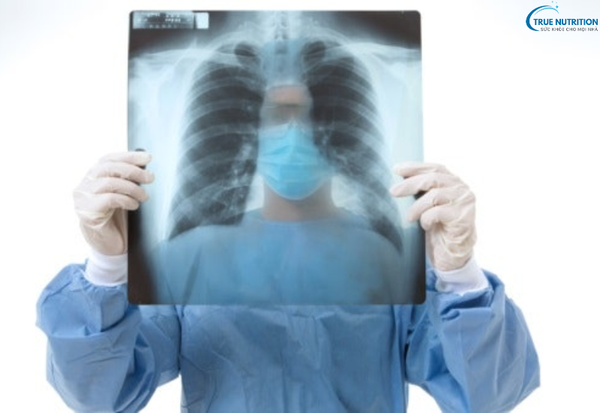 Triệu chứng bệnh bụi phổi: Những dấu hiệu cảnh báo không thể bỏ qua