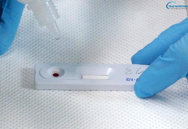 Cách Phòng Bệnh HIV/AIDS: Những Biện Pháp Cần Biết Để Bảo Vệ Sức Khỏe