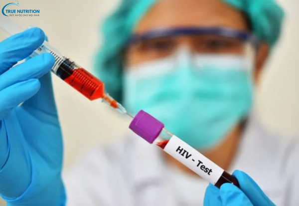 Cách Phòng Bệnh HIV/AIDS: Những Biện Pháp Cần Biết Để Bảo Vệ Sức Khỏe