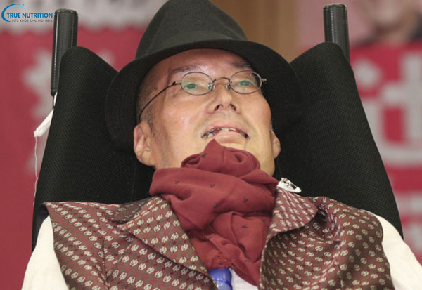 Bệnh Lou Gehrig Là Gì? Tìm Hiểu Về Bệnh ALS và Tác Động Đến Cuộc Sống