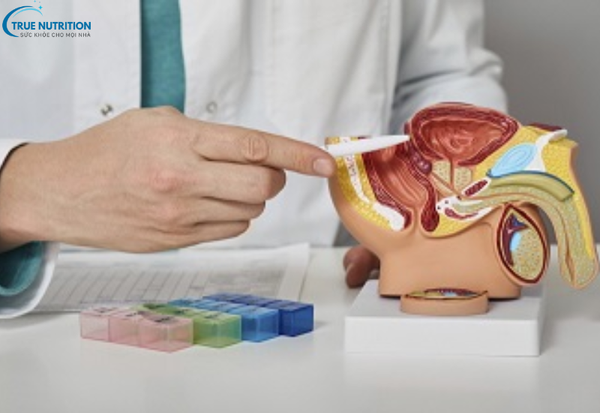 Bệnh Phì Đại Tuyến Tiền Liệt: Nguyên Nhân và Cách Phòng Ngừa Hiệu Quả
