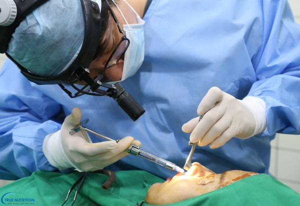 Cách chữa bệnh polyp mũi: Phương pháp điều trị và phòng ngừa tái phát