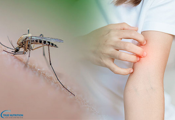 Cách Phòng Tránh Bệnh Sốt Rét: Những Lời Khuyên Giúp Ngăn Ngừa Bệnh