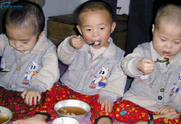 Nguyên Nhân Bệnh Suy Dinh Dưỡng: Điều Gì Khiến Cơ Thể Thiếu Hụt Dinh Dưỡng?