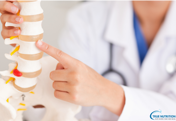 Nguyên Nhân Bệnh Thoái Hóa Khớp: Những Yếu Tố Gây Ra Cơn Đau Khớp