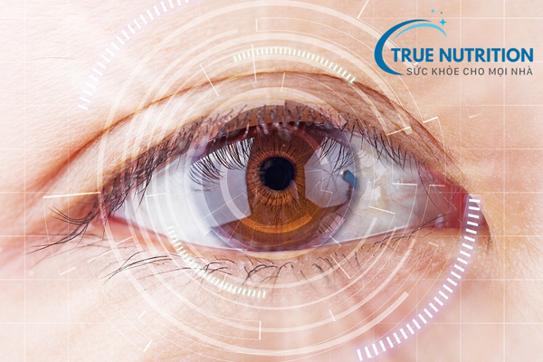 Tiểu Đường và Đục Thủy Tinh Thể