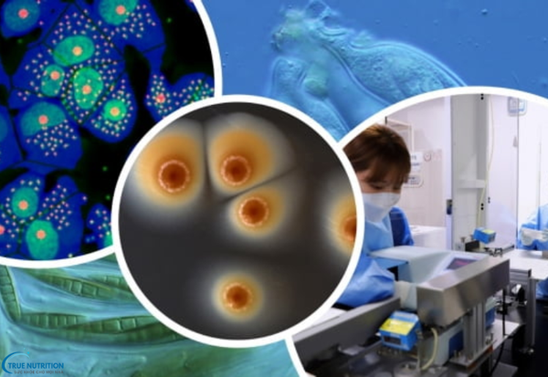 Bệnh Trichomonas vaginalis là gì? Những Điều Cần Biết Để Phòng Ngừa