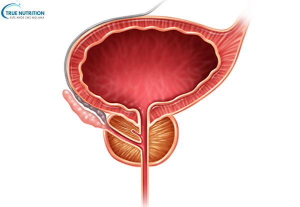 Dấu Hiệu Bệnh Ung Thư Bàng Quang : Cảnh Báo Từ Những Biểu Hiện Đầu Tiên