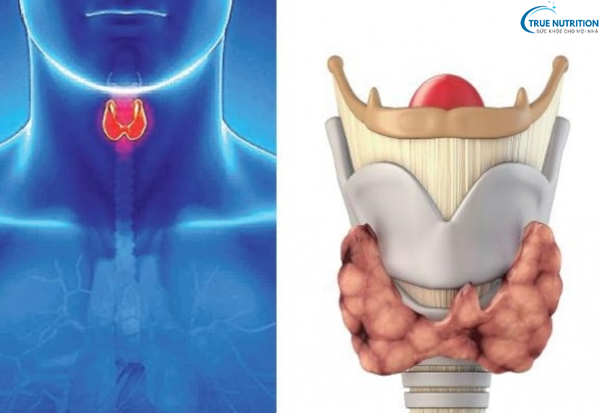 Triệu Chứng Của Bệnh Ung Thư Thanh Quản: Những Dấu Hiệu Bạn Cần Biết