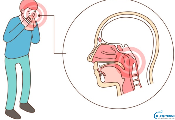 Triệu Chứng Bệnh Ung Thư Vòm Họng: Dấu Hiệu Cảnh Báo Cần Chú Ý Sớm
