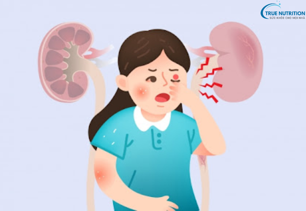 Bệnh Viêm Cầu Thận: Hiểu Đúng Bệnh Lý Và Giải Pháp Điều Trị Hiệu Quả