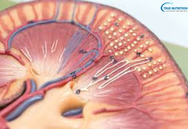 Bệnh Viêm Cầu Thận: Hiểu Đúng Bệnh Lý Và Giải Pháp Điều Trị Hiệu Quả