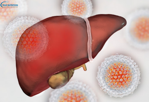 Dấu hiệu bệnh viêm gan B: Những triệu chứng không nên bỏ qua