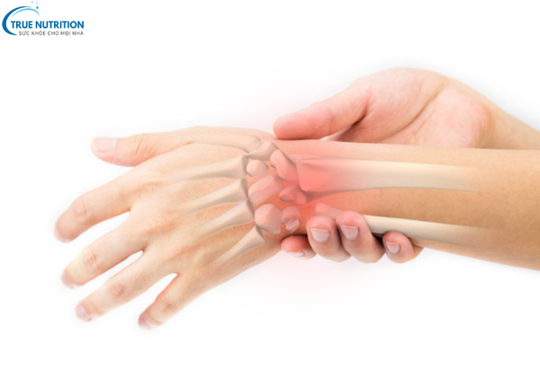 Triệu Chứng Viêm Khớp Dạng Thấp: Những Biểu Hiện Để Điều Trị Kịp Thời