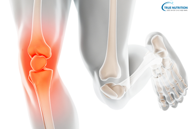 Triệu Chứng Viêm Khớp Dạng Thấp: Những Biểu Hiện Để Điều Trị Kịp Thời