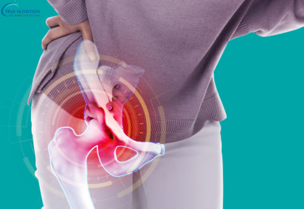 Dấu hiệu bệnh viêm vùng chậu: Nhận biết sớm để bảo vệ sức khỏe phụ nữ