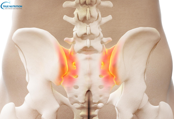 Dấu hiệu bệnh viêm vùng chậu: Nhận biết sớm để bảo vệ sức khỏe phụ nữ