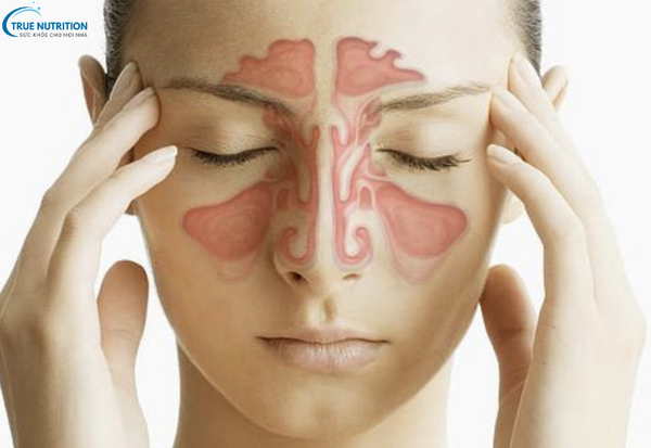 Dấu Hiệu Bệnh Viêm Xoang: Cách Nhận Biết Sớm Để Điều Trị Kịp Thời