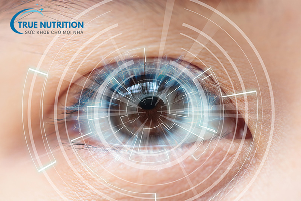 Bệnh Võng Mạc Tiểu Đường