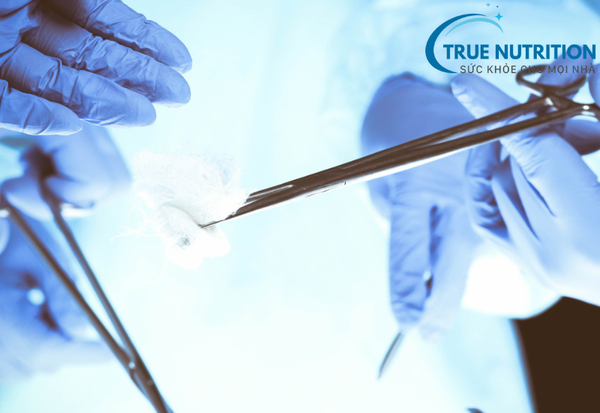 Bị Tiểu Đường Có Mổ Được Không? Những Điều Cần Biết Cho Quyết Định An Toàn Sức Khỏe!