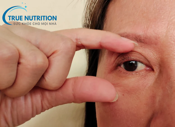 Biến Chứng Tiểu Đường Lên Mắt