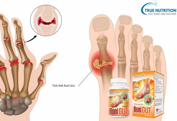 Bonigut Có Tác Dụng Gì? Khám Phá Những Lợi Ích Sức Khỏe Của Sản Phẩm Này