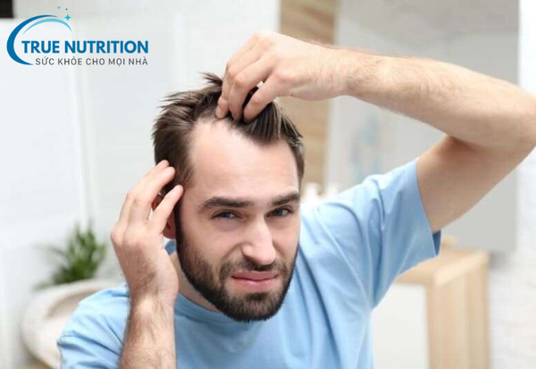 Rụng tóc: Nguyên nhân, cách điều trị và biện pháp giảm rụng tóc