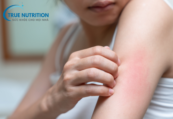 Giang Mai: Bệnh Lây Truyền Qua Đường Tình Dục Cần Cảnh Giác