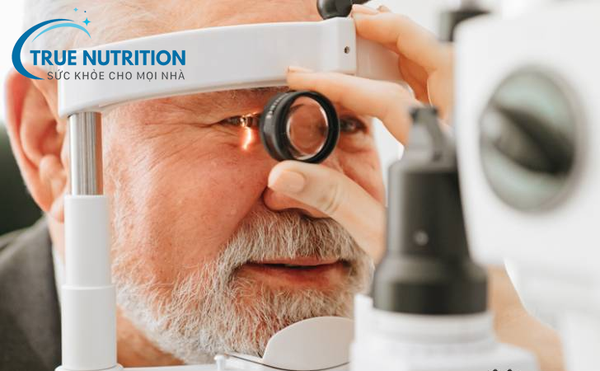 Tiểu Đường và Đục Thủy Tinh Thể