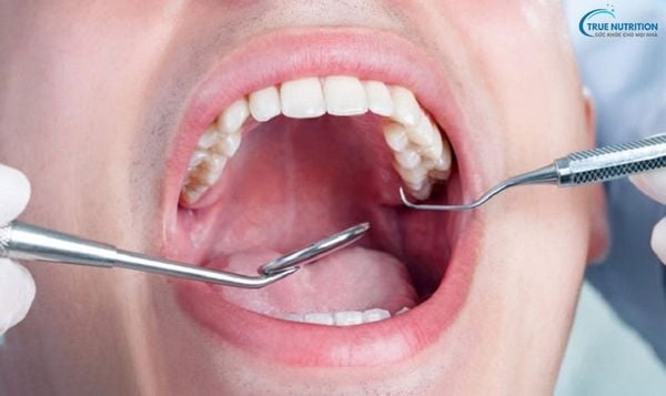 Cách Nhổ Răng Không Đau & An Toàn Nhất Hiện Nay