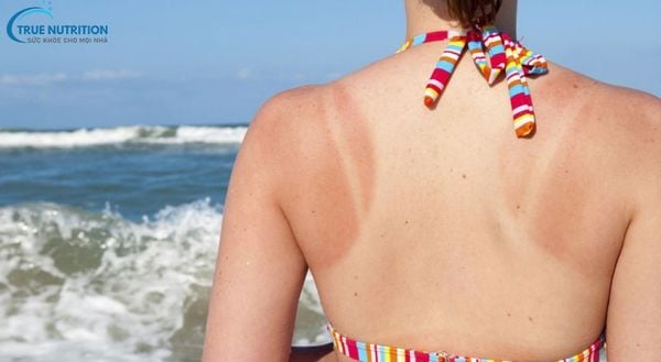 Cách Nhả Nắng Nhanh, Khi Nào Da Mới Nhả Nắng?