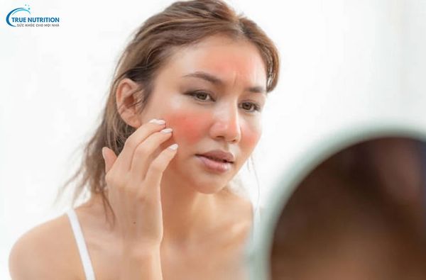 Cách Nhả Nắng Nhanh, Khi Nào Da Mới Nhả Nắng?