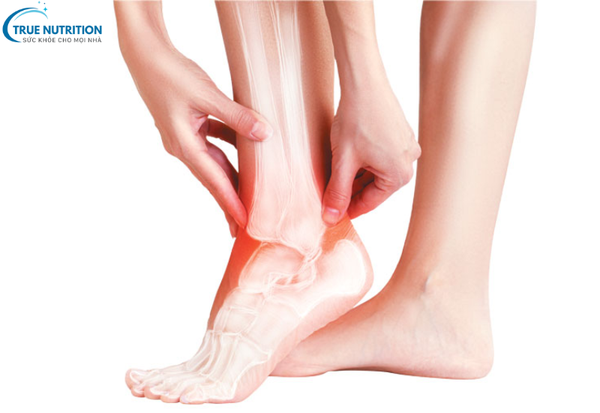 Ghép Dây Chằng: Giải Pháp Hiệu Quả Để Khôi Phục Chức Năng Khớp Gối