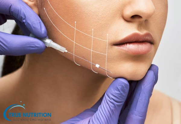 Căng Chỉ Da Mặt: Phương Pháp Trẻ Hóa Da Hiệu Quả Và Tiện Lợi