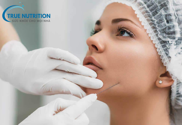 Căng Chỉ Da Mặt: Phương Pháp Trẻ Hóa Da Hiệu Quả Và Tiện Lợi