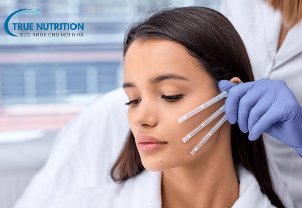 Căng Chỉ Da Mặt: Phương Pháp Trẻ Hóa Da Hiệu Quả Và Tiện Lợi