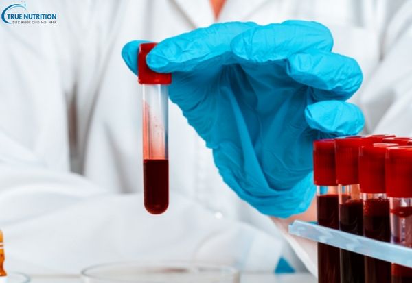 Nguyên Nhân Gây Bệnh Hemophilia: Di Truyền và Các Yếu Tố Cần Biết