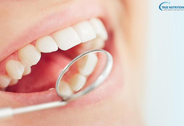Bệnh Răng Vẩu Nặng Là Gì? Cách Điều Trị Giúp Lấy Lại Nụ Cười Tự Tin