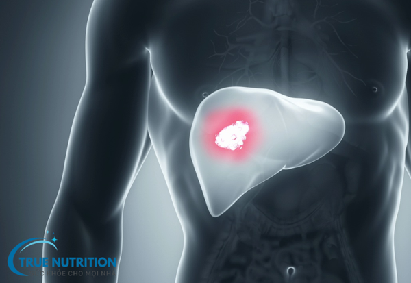 Ung Thư Gan: Các thông tin cần biết và phương pháp điều trị
