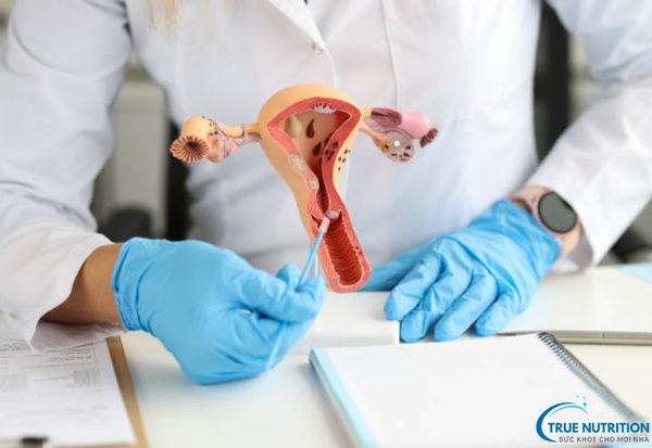 Bệnh Lạc Nội Mạc Tử Cung: Dấu Hiệu Nhận Biết, Cách Điều Trị Tối Ưu
