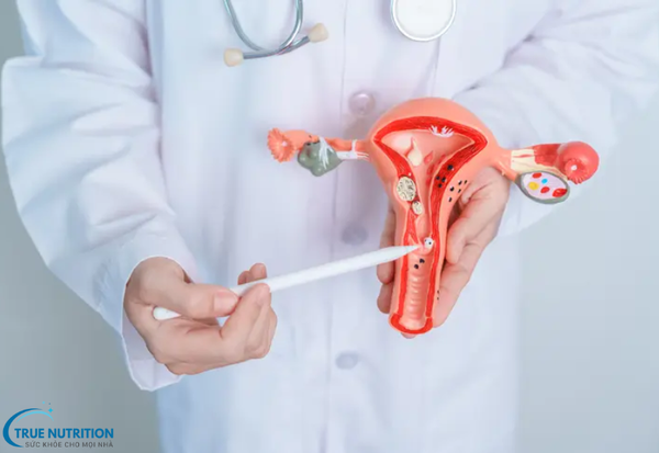 Bệnh Lạc Nội Mạc Tử Cung: Dấu Hiệu Nhận Biết, Cách Điều Trị Tối Ưu